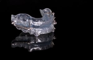 oral appliance