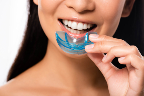 Woman,Using,Mouth,Guard